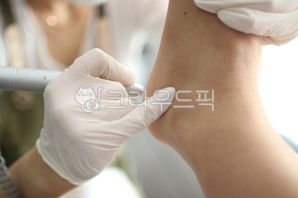 발각질,발바닥각질,각질제거,발케어,풋케어,발꿈치,발꿈치각질,발네일아트