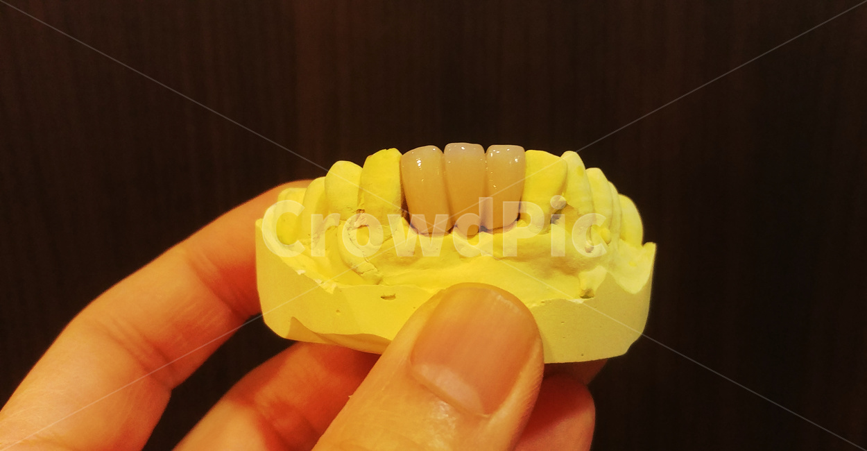 치과,이빨,치아,지르코니아,의료,의사,zirconia,보험