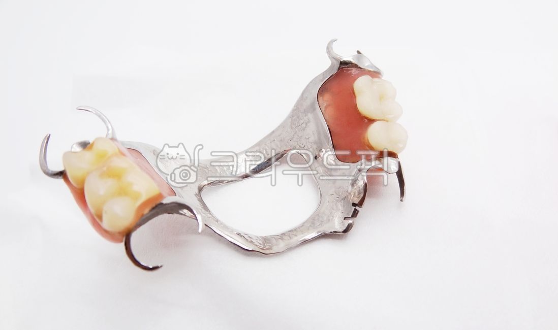 틀니,치과,부분틀니,보철,치과의원,치과병원,치과의사,치과기공,금속,클래스프,레진,치아,의치,국소의치,의료보험,보험틀니,오래된,낡은,국민건강보험,보험수가,의료,보건,치의학,구강보건,구강위생,상악,환자,노인환자,dental,dentist,prosthetics,patient,teeth,resin,oral,denture,의료,의학,병원,medical,hospital,clinic