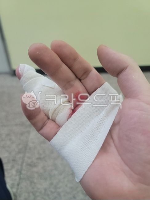 응급조치,출혈,손가락,다친손,오른손,injury,부상,수술,오른손다침