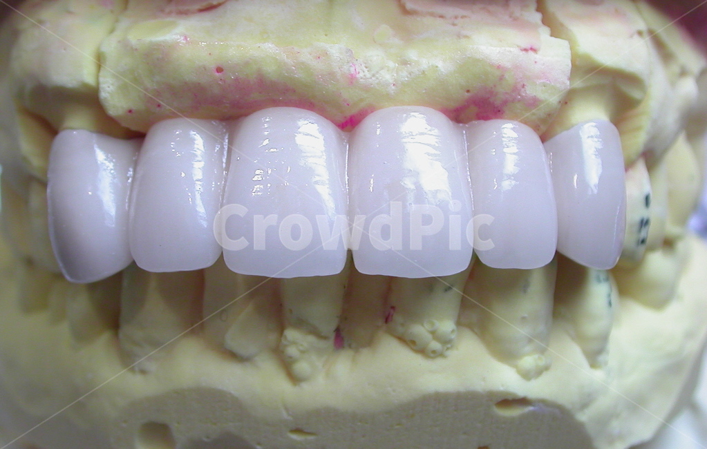 치과,이빨,치아,보철,덴탈,dental,전치,앞니,의료,의학,병원,medical,hospital,clinic