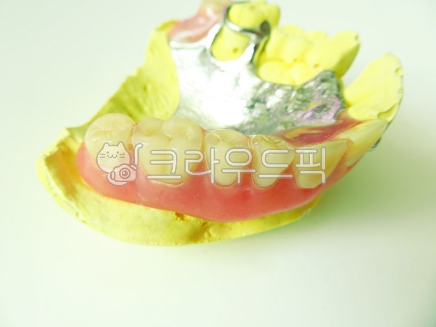 틀니,의치,치과,부분틀니,국소의치,가철성국소의치,레진,치아,석고,구강,구강모형,구강보건,구강위생,의료,보건,의학,치의학,치과의원,치과병원,치과기공,치과의사,보철,건강보험,보험틀니,치과재료,상악,환자,노인,치아수복,teeth,mouth,denture,dental,dentist