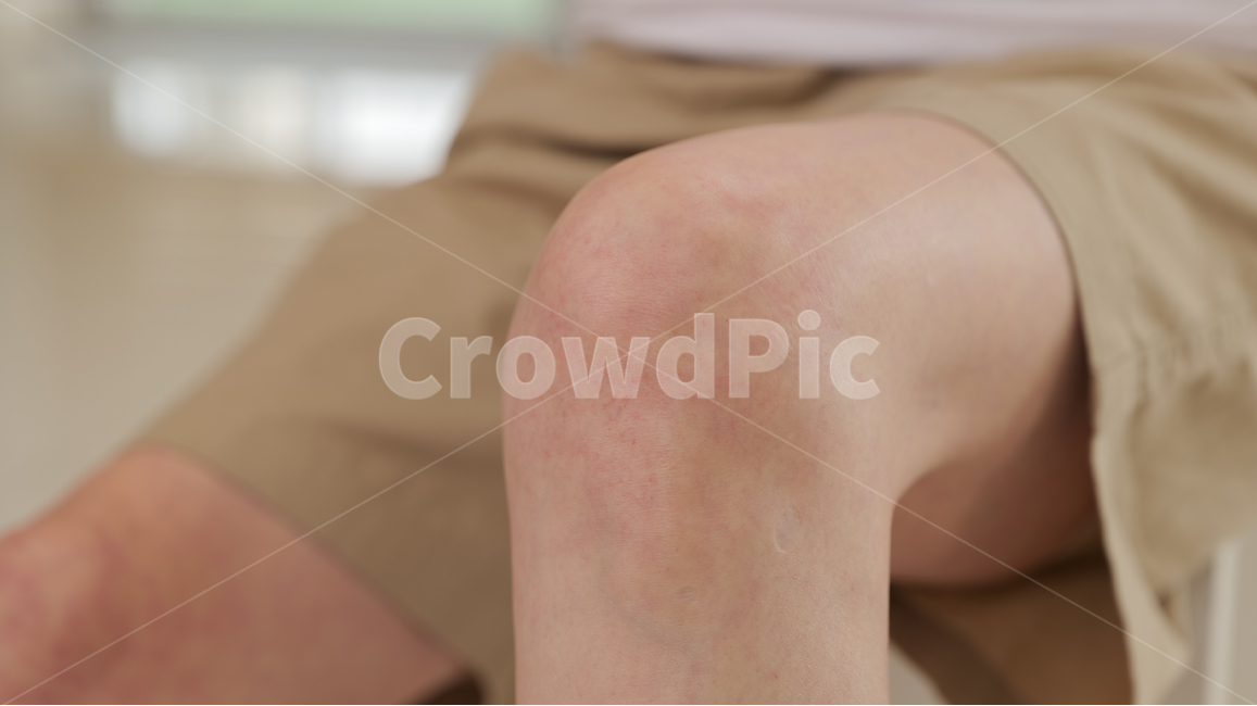 무릎,knee,human,인간,person,사람,body,몸,미용,뷰티,신체,다리,사람,인물,인간,human,person,신체일부,몸,body
