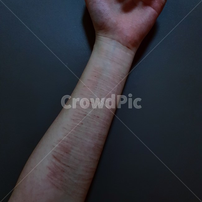 팔,자해,상처,스트레스,아픔,드려움,어두움,떨림,대인관계,감성사진,사람,인물,인간,human,person,신체일부,몸,body