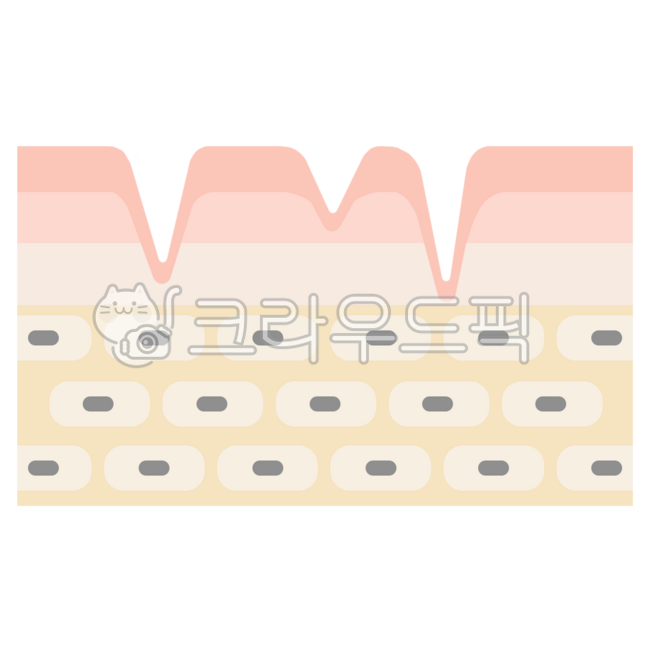 피부,피부과,주름,피부층,주름표면,각질,각질층,진피,표피,과립층,성형외과,피부관리,에스테틱