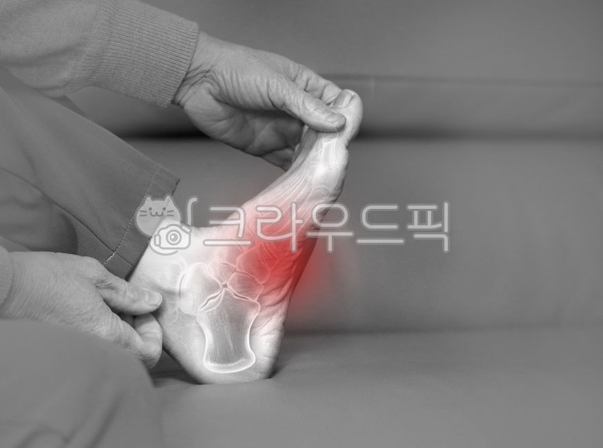 foot,foot pain,sole,sole pain,orthopedics