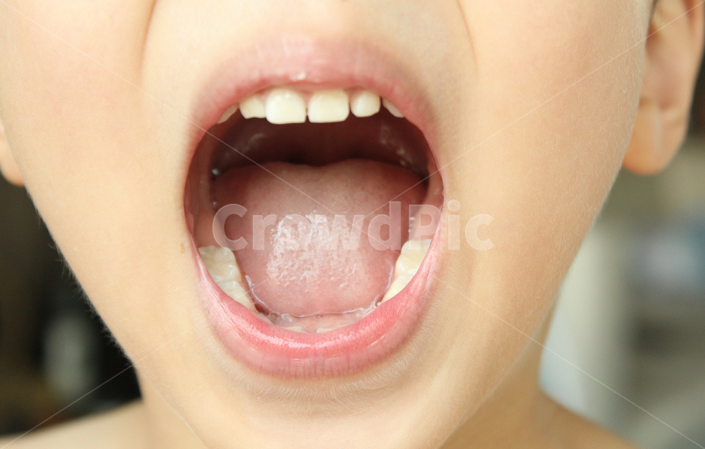 동양인,남자,어린이,아이,아동,남자아이,얼굴,신체,신체부위,입,입술,입벌린,벌리다,벌린,치아,이,혓바닥,정면,사람,인물,인간,human,person,신체일부,몸,body,어린이,어린아이,child,children,kid