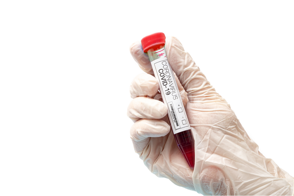 medical,covid,diagnostic kit,Science,rapid,white background,virus,latex,red,gloves,supplies,kit,examination,corona,gene amplification,disease,test,coronavirus,diagnosis,equipment,medicine,analysis,blood,covid19,tube,vaccine,laboratory,infectious disease,b