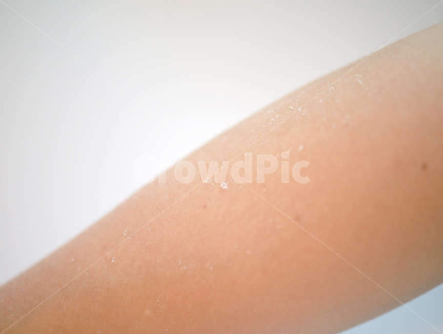 skin,피부,각질,선크림,태닝,피부화상,화상,팔,사람,인물,인간,human,person,신체일부,몸,body