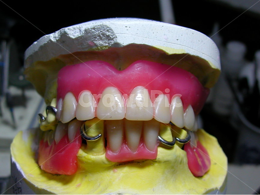 치과,의료,보험,틀니,덴쳐,치과기공사,denture,노인,보철,의치,교합,의료,의학,병원,medical,hospital,clinic