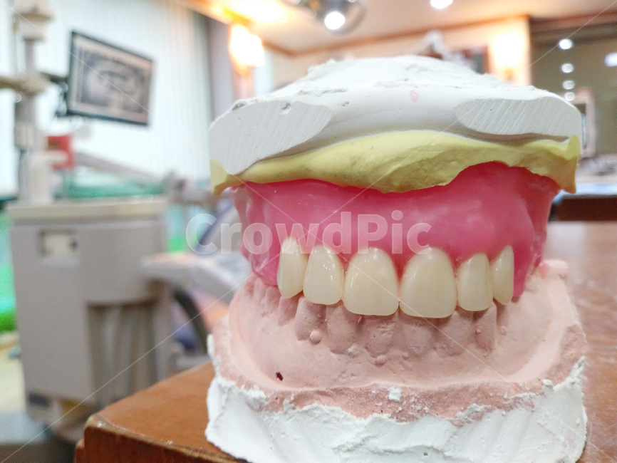 teeth,이,mouth,입,jaw,턱,틀니,치과,치과치료,보철,denture,dental,구강,건강,healthcare,구강위생,구강건강,구강보건,병원,클리닉,clinic,hospital,치아,치과의원,치과병원,의료,의학,병원,medical,hospital,clinic