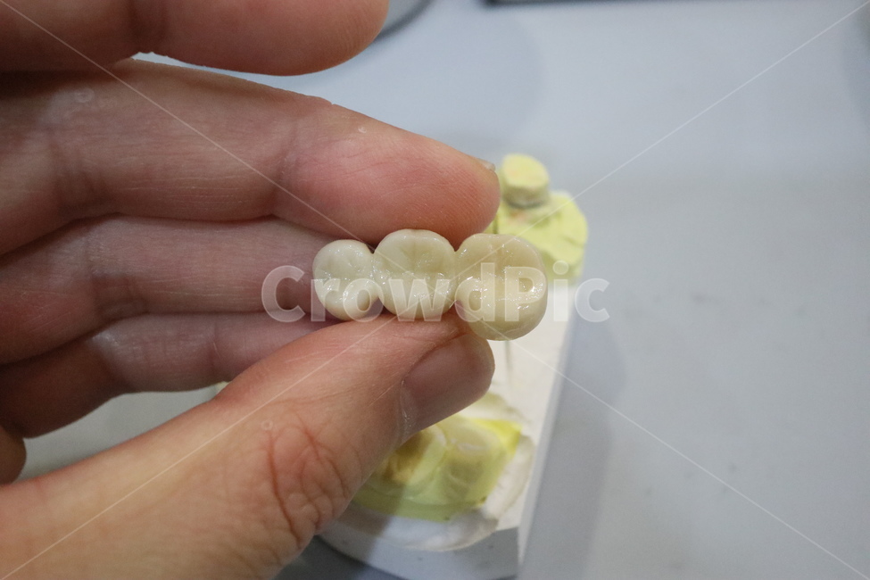 치과,보철,지르코니아,덴탈,dental,zirconia,의료,의학,병원,medical,hospital,clinic