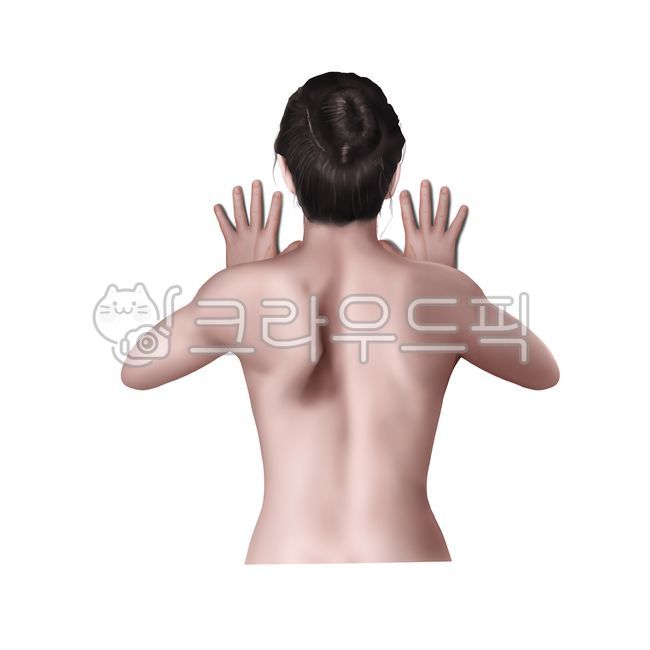 익상견갑골,장흉신경마비,메디컬,일러스트,의학,그림