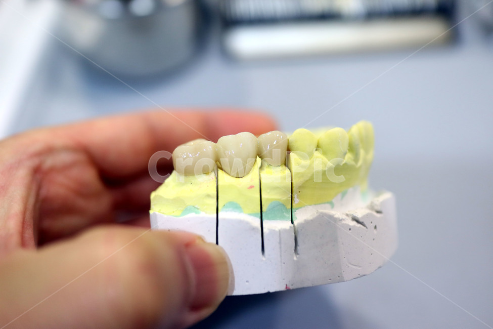 치과,보철,지르코니아,zirconia,이빨,덴탈,치아,의료,보험,의료,의학,병원,medical,hospital,clinic