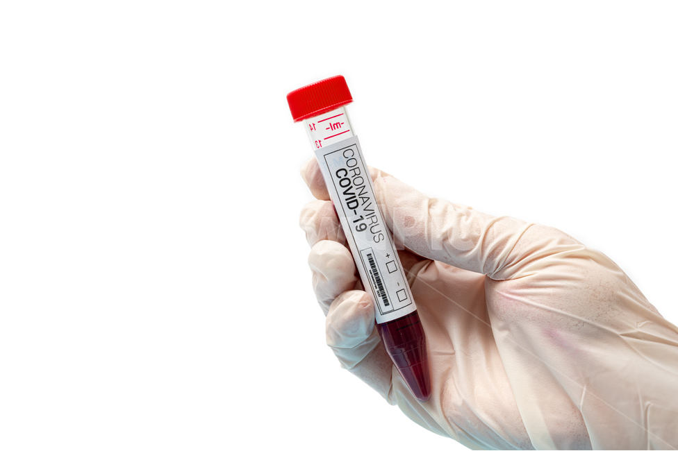 medical,covid,diagnostic kit,Science,rapid,white background,virus,latex,red,gloves,supplies,kit,examination,corona,gene amplification,disease,test,coronavirus,diagnosis,equipment,medicine,analysis,blood,covid19,tube,vaccine,laboratory,infectious disease,b