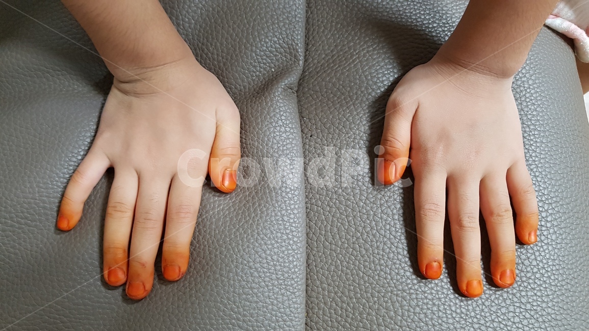 봉숭아,여름,꽃,식물,손톱,손,배경,바탕,hand,물감,색칠,놀이,전통,신체일부,몸,body