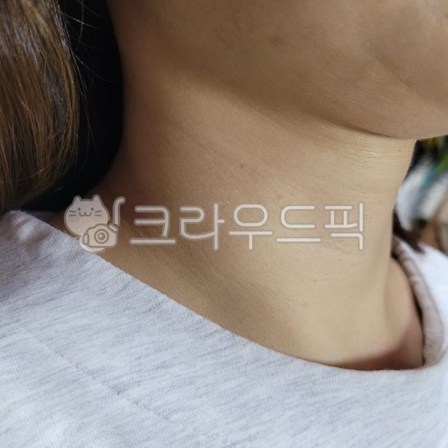 여자,여자목,목주름,여자목주름,30대여자,20대여자,30대여자목주름,20대여자목주름,목선,목,body,neck넥라인,목라인,주름,여자주름,여자피부,노화,피부노화,노화피부,나이든,늙은,늙어가는,나이들어가는,neck