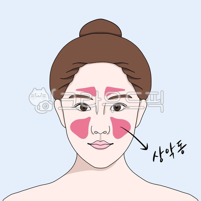 상악동,상악동위치,상악동거상술,상악임플란트,여자얼굴,클로즈업