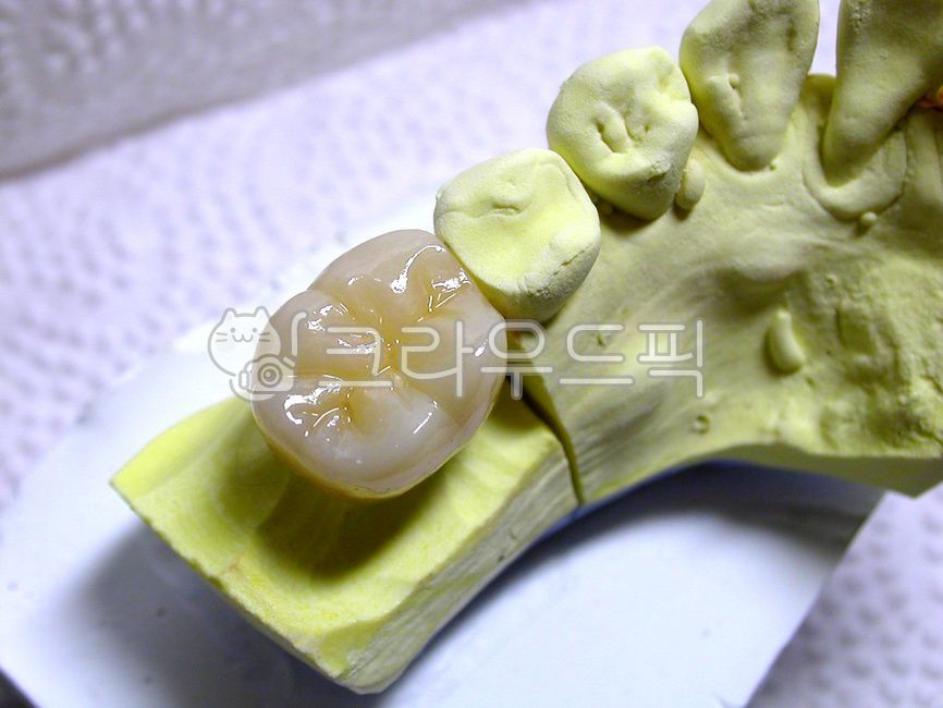 ceramic,dental,Dentist,prosthetics,molars,dental technician,zirconia,molar