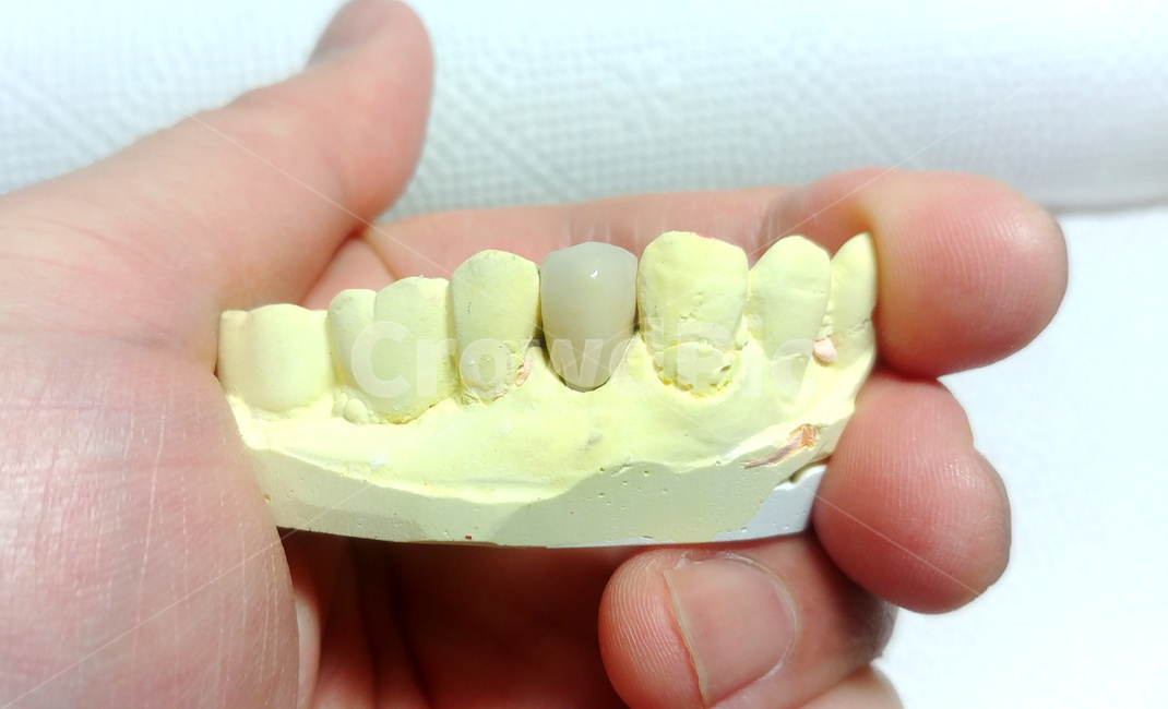 보철,치과,덴탈,dental,치아,인공치,치과기공사