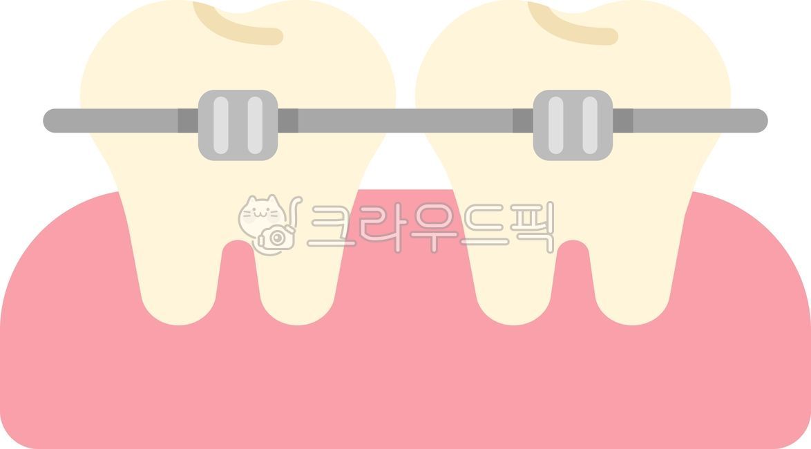 Correction,orthodontics,teeth,teeth,orthodontics,dentistry,dental orthodontics,orthodontic dentistry,orthodontic teeth,orthodontics illustration,orthodontics illustration,teeth illustration,this,hospital,dental treatment,dental treatment,d