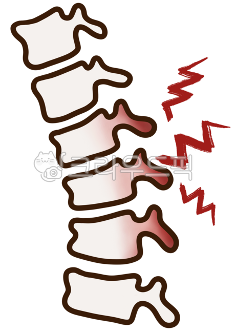 추나,디스크,허리디스크,척추,정형외과,물리치료,추나요법,cmt,chunamanualtherapy,disk,spine,orthopedics