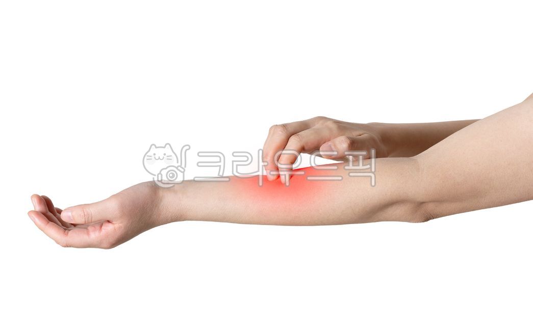 소양증,가려움증,가려운,긁는,간지럼,간지러운,가려움,고통,건조,피부,스킨케어,팔,pruritus,tickling,pain,dryness,skin,skincare,arm,woman,hand,medicalbeauty,skinrash,lucky,studio,skindisease,body,bite,finger,disease,dry,symptom,isolated,itch,allergic,scratch,atopic,allergy,care,dermatitis,itchy,health,dermatology,red,highlight,mark,여자,손,의료뷰티,하이라이트,표시,강조,부분,레드,빨간색,마킹,피부발진,누끼,스튜디오,피부병,관리
