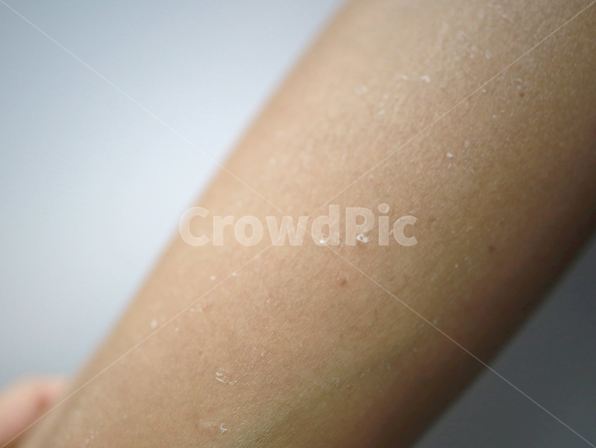 skin,피부,각질,선크림,태닝,피부화상,화상,팔,사람,인물,인간,human,person,신체일부,몸,body