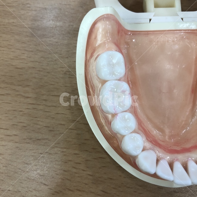 mouth,입,teeth,이,치아,덴티폼,치위생과,의료,의학,병원,medical,hospital,clinic