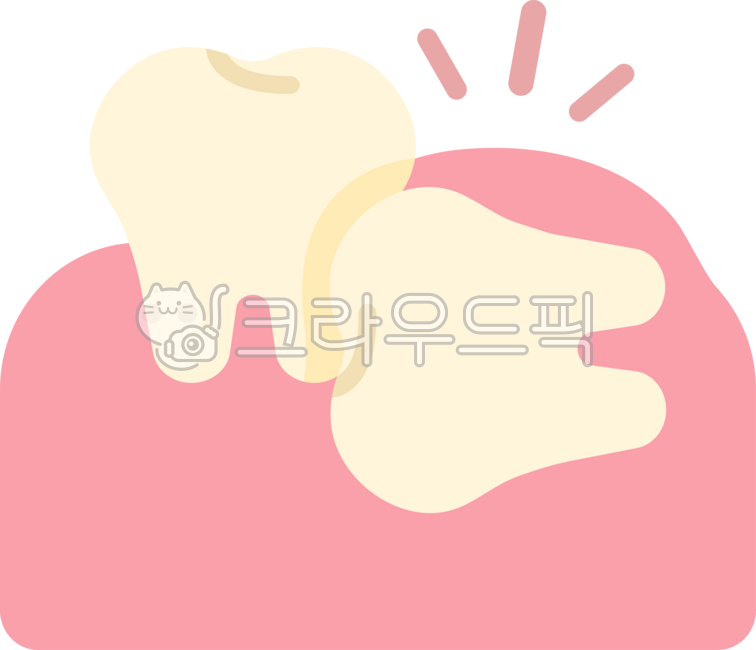 Impacted wisdom tooth,wisdom tooth,wisdom tooth extraction,wisdom tooth extraction,wisdom tooth pain,extraction,wisdom tooth rash,back molar,molar,wisdom tooth removal,dentistry,teeth,teeth,this,wisdomtooth,dental,dentist,tooth,teeth,gu
