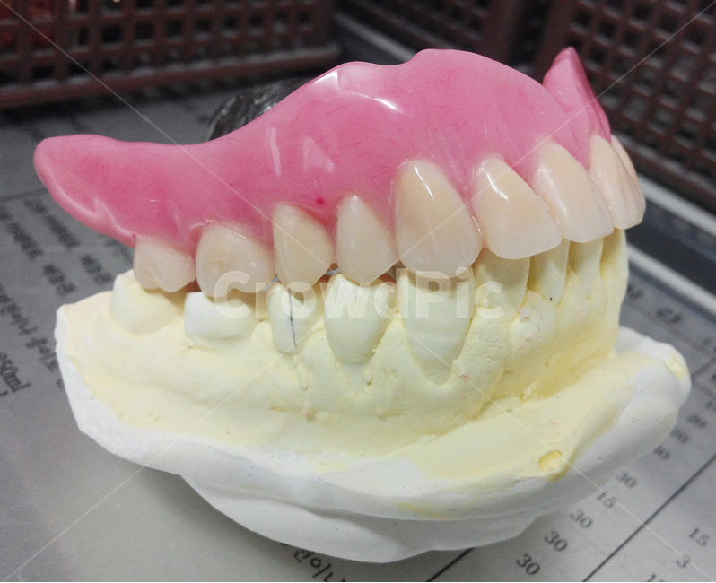 의료,치과,틀니,치아,dental,치료,성형,보철,denture,이빨,석고,치과기공,의치,교합,조각상,동상,석상,조형물,statue,bronze statue,stone statue,의료,의학,병원,medical,hospital,clinic,사물,물건,오브젝트,thing,object,matter