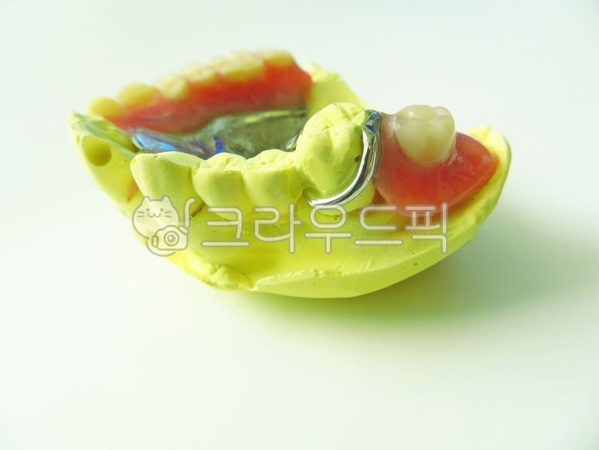 oral model,ring,dentistry,Dentist,plate,denture,dental clinic,old man,dental,Resin,prosthetics,patient,teeth,Diagnosis,Health Insurance,oral hygiene,maxilla,Removable partial denture,therapy,metal,oral health,insurance dentures,diagnosis,gypsum,dentist,pa