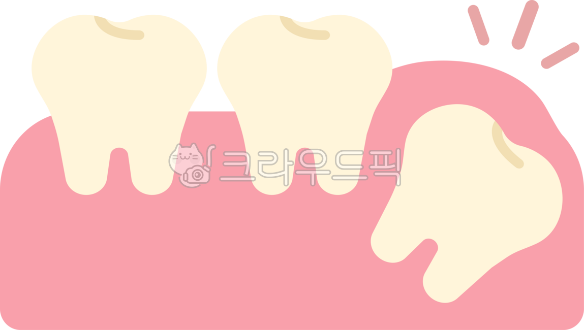 Impacted wisdom tooth,wisdom tooth,wisdom tooth extraction,wisdom tooth extraction,wisdom tooth pain,extraction,wisdom tooth rash,back molar,molar,wisdom tooth removal,dentistry,teeth,teeth,this,wisdomtooth,dental,dentist,tooth,teeth,gu