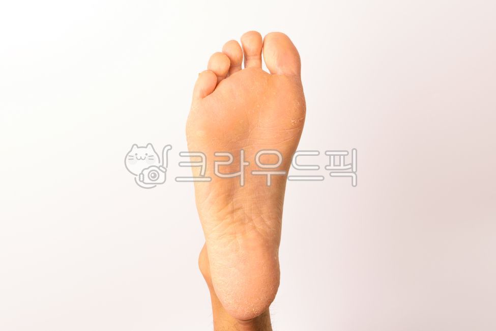 발,발가락,관절염,발톱,신체,감염,질병,맨발,건조한,남성,의료,건강,해부학,다리,의학,heel,힐