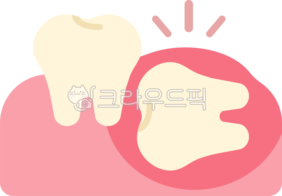 매복사랑니,사랑니,사랑니발치,사랑니추출,사랑니통증,발치,사랑니발진,뒷어금니,어금니,사랑니제거,치과,이빨,치아,이,wisdomtooth,dental,dentist,tooth,teeth,잇몸,치과치료,충치치료