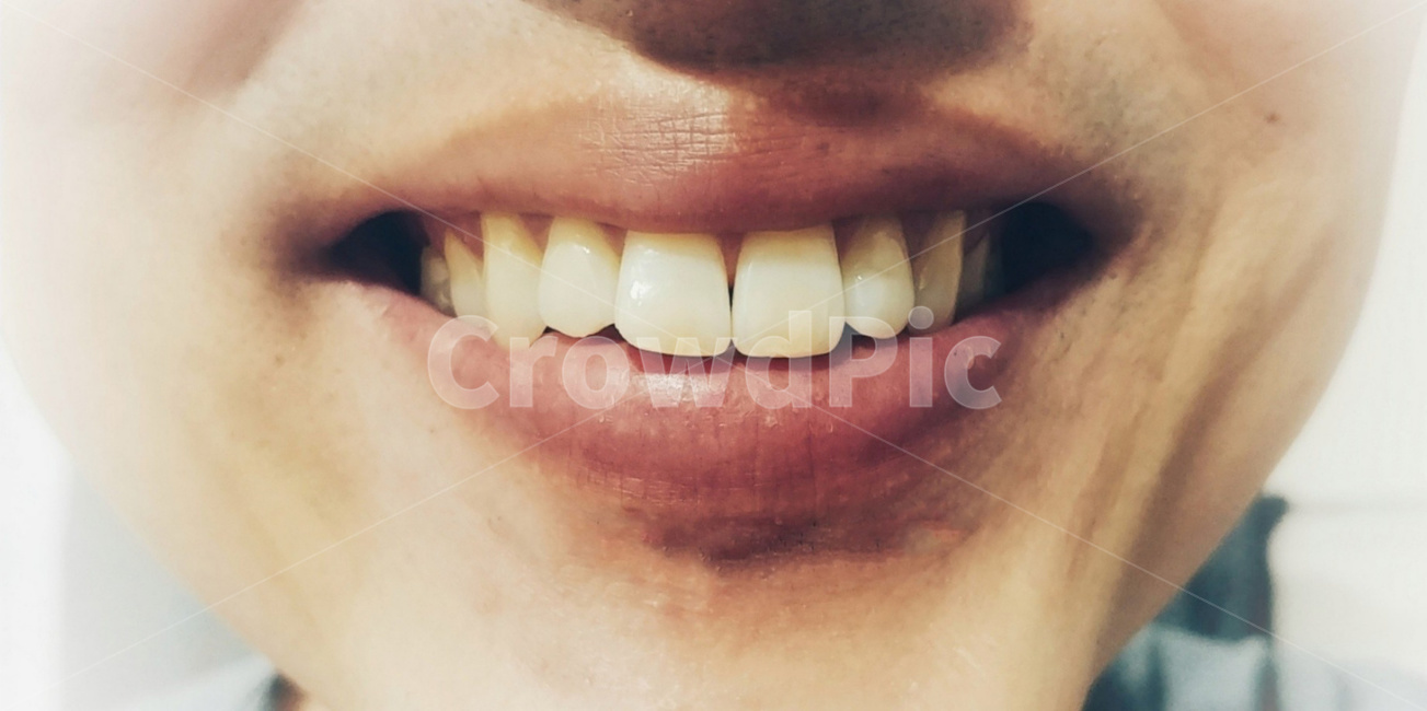 입술,입,치아,이빨,이,미소,스마일,smile,teeth,lip,mouth,앞니,건치,웃음,웃어요,치과,신체,웃는얼굴
