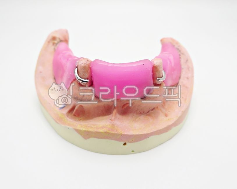 치과,틀니,의료,보건,구강,프레임,금속,클래스프,왁스,왁스림,핑크,치아,석고,모형,하악,구강보건,치의학,보철,인공적인,치과기공,치료,진료,wax,artificial,dentistry,dental,teeth,treatment,medical,denture