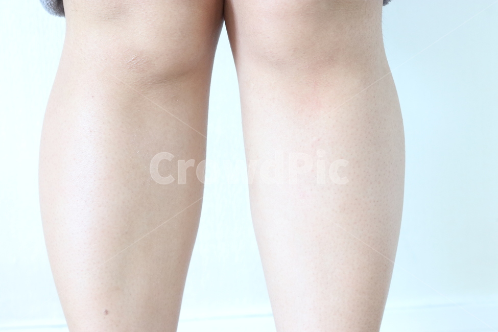 스크럽,각질제거,닭살,각질,피부,skin,다리,무릎,종아리,사람,인물,인간,human,person,신체일부,몸,body