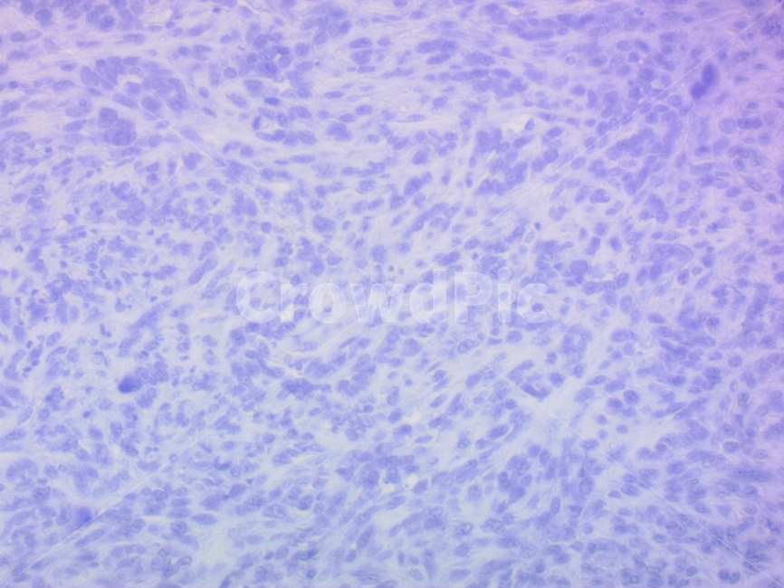 세포,염색,화학염색,조직염색,생명과학,cell,biology,실험,연구,laboratory,immune,immunostaining,세포염색,과학,실습