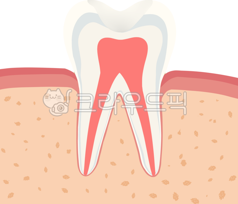 어금니,충치,신경치료,치아,치과,염증,크라운,인레이,레진,치경부,마모,잇몸,치주