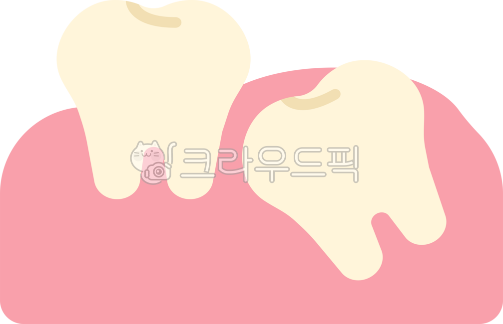 Impacted wisdom tooth,wisdom tooth,wisdom tooth extraction,wisdom tooth extraction,wisdom tooth pain,extraction,wisdom tooth rash,back molar,molar,wisdom tooth removal,dentistry,teeth,teeth,this,wisdomtooth,dental,dentist,tooth,teeth,gu