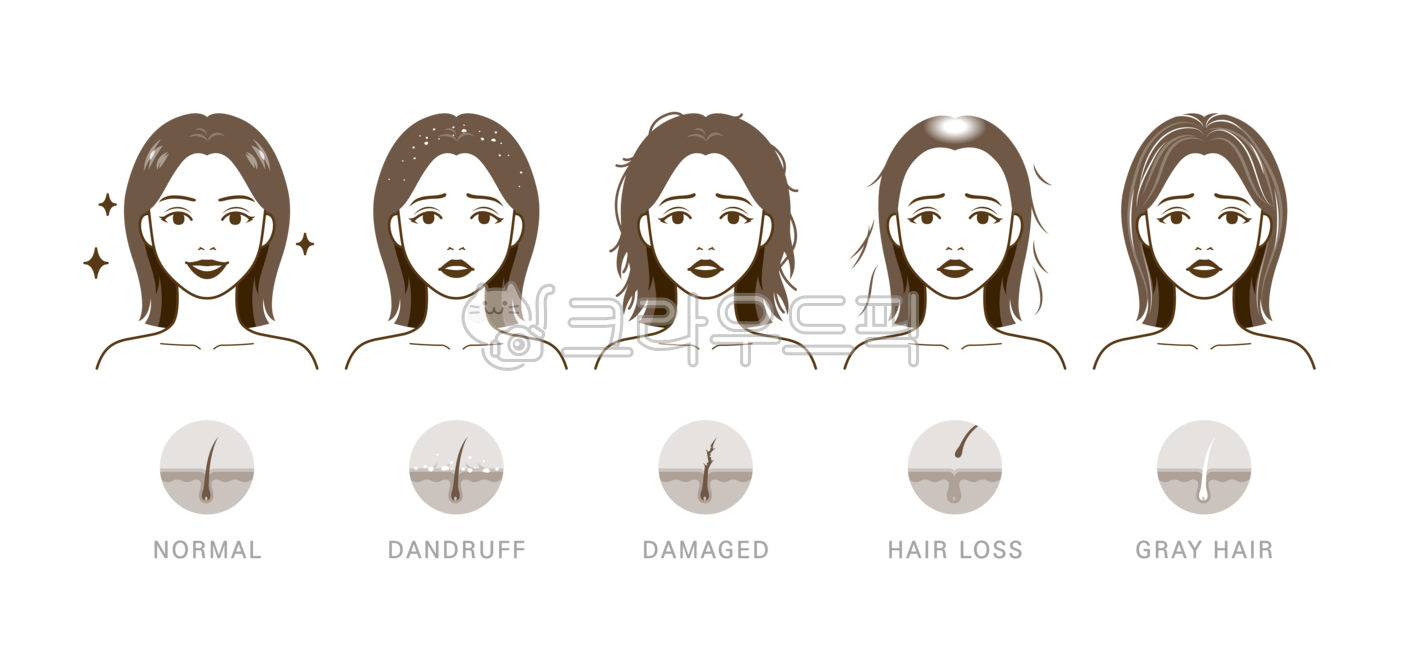 머리,머리카락,모발,머릿결,빠짐,탈모,원형탈모,머리빠짐,풍성한,뺵빽한,머리숱,숱,흰머리,새치,노화,볼륨,문제,손상된,손상모,갈라짐,갈라진,푸석푸석한,푸석한,부스스한,비듬,각질,여자,여성,사람,인물,모델,얼굴,캐릭터,미용,관리,일러스트,비교,세트,예쁜