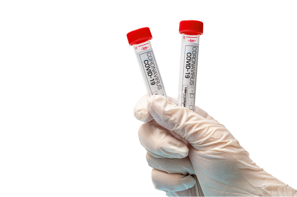 medical,covid,diagnostic kit,Science,rapid,white background,virus,latex,red,gloves,supplies,kit,examination,corona,gene amplification,disease,test,coronavirus,diagnosis,equipment,medicine,analysis,blood,covid19,tube,vaccine,laboratory,infectious disease,b