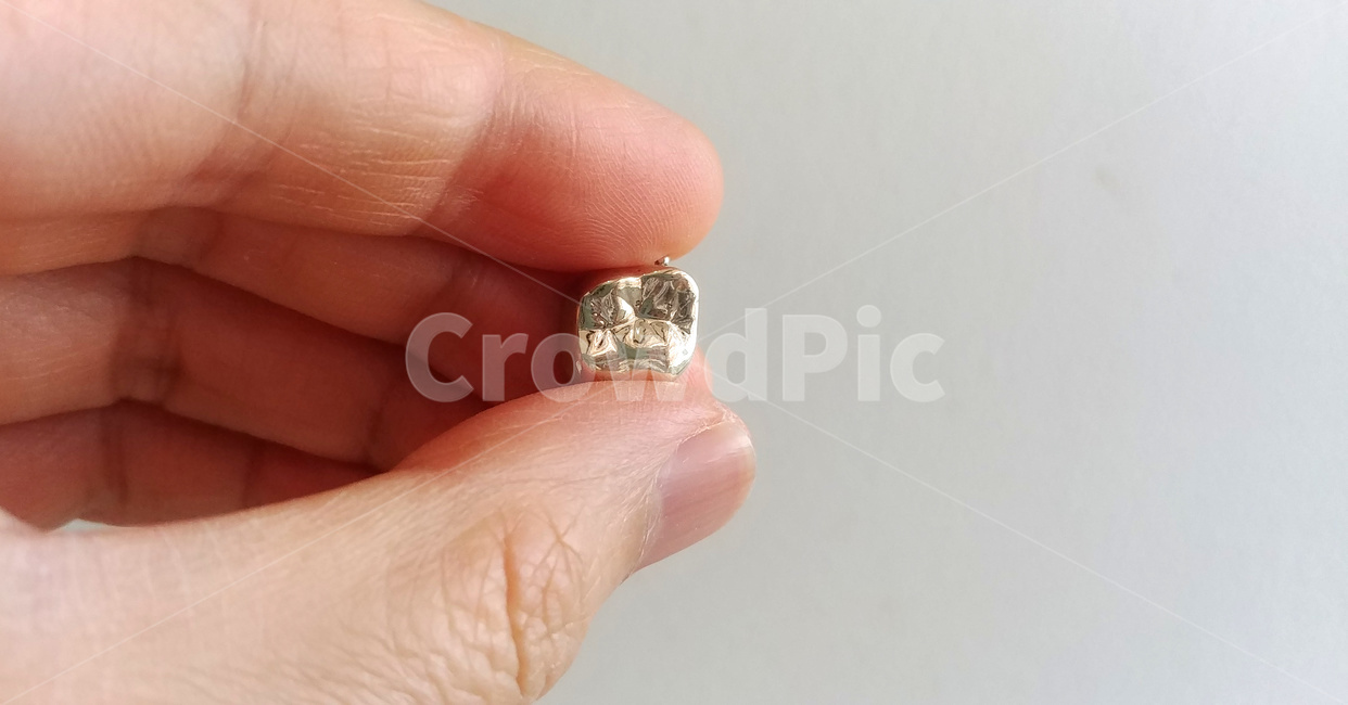 금니,치과,이빨,보철,골드,크라운,gold,세공,덴탈,구강,골드크라운