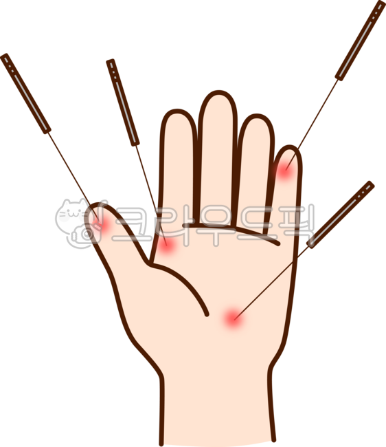손,손가락,손바닥,혈자리,침,침치료,의료,병원,의학,건강,한의원,한의학,의술,치료,테라피