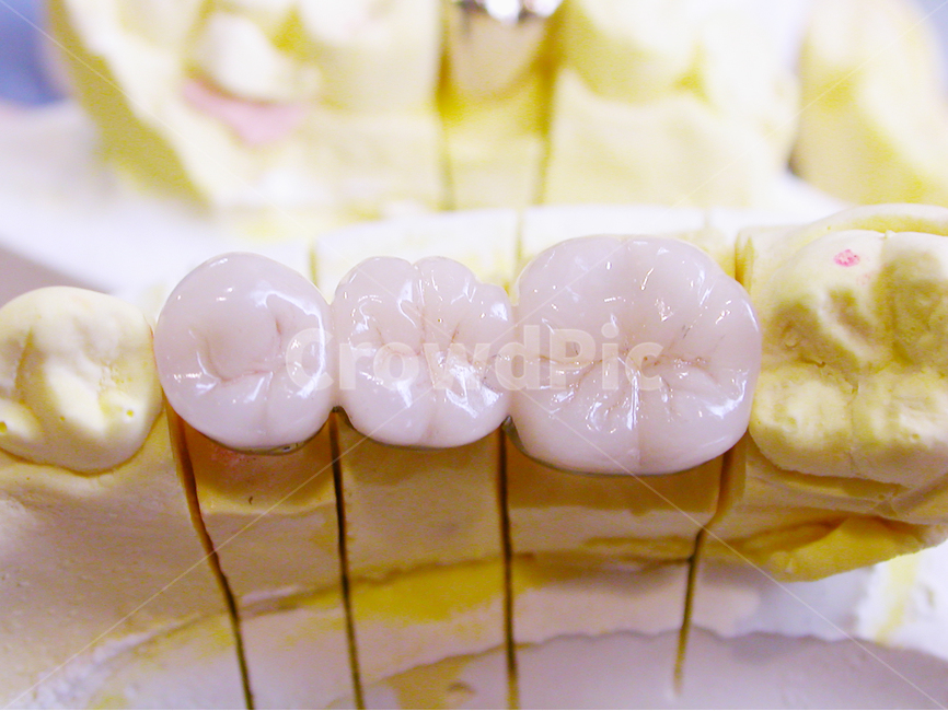 치과,의료,치아,이빨,인공치,포세린,poccelain,도자기,기공,보철,덴탈,지르코니아,dental,의료,의학,병원,medical,hospital,clinic,사물,물건,오브젝트,thing,object,matter