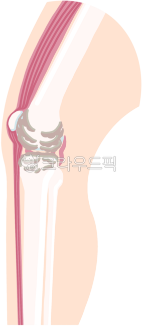 관절,무릎,관절염,정형외과,관절수술,인공관절,퇴행성,퇴행성관절염,관절염진행,무릎뼈,뼈,인체,다리,염증,노화,관절노화