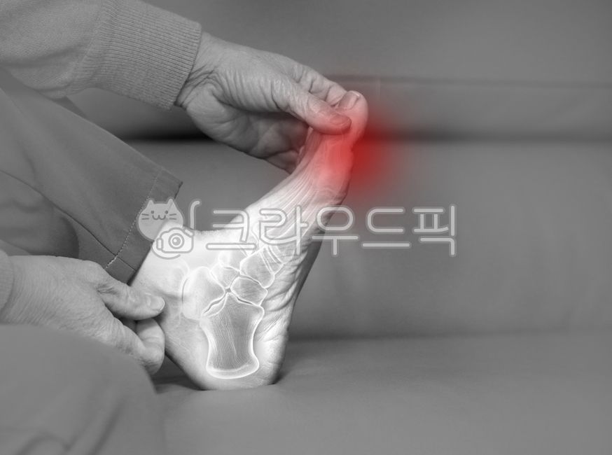 foot,foot pain,sole,sole pain,orthopedics