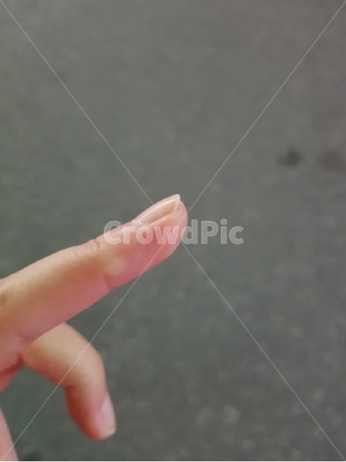 엄지,손가락,모기물림,저쪽,여자,손,일상,여름,모기,자국,사람,손톱,자연스러움,소녀