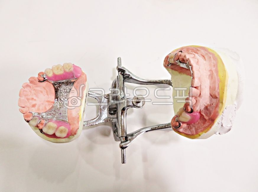 보험틀니,건강보험,틀니,의치,치과,치과의사,국소의치,부분틀니,보험수가,금속,프레임,교합기,치아,구강,모형,레진,왁스,상악,하악,구강보건,보건,의료,의학,치의학,보철,치과기공,치과재료,oral,healthcare,teeth,dental,dentist,hospital,denture,partial,wax,resin